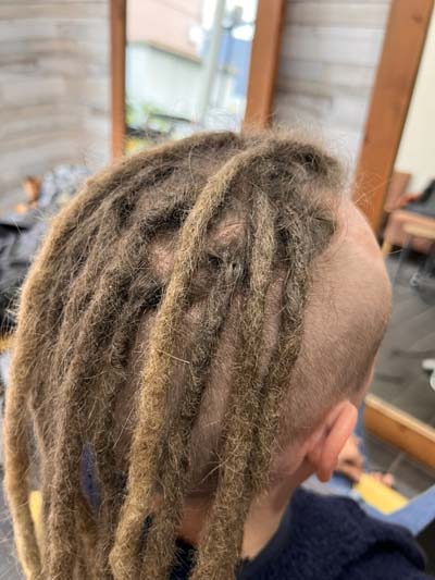 ドレッド修理後:39年の技術で完治。After dreadlocks repair: 39 years needle technique.2